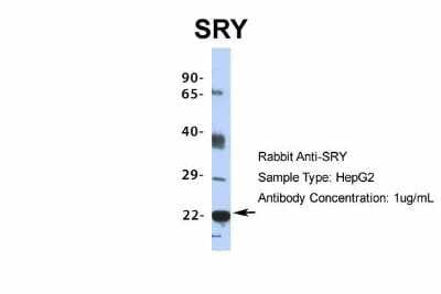 Western Blot: SRY Antibody [NBP2-82349]