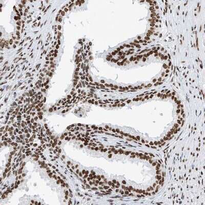 Immunohistochemistry-Paraffin: SRp55 Antibody [NBP1-90043]