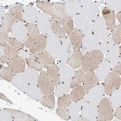 Immunohistochemistry-Paraffin: SRp55 Antibody [NBP1-90043]