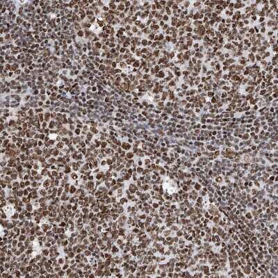 Immunohistochemistry-Paraffin: SRp55 Antibody [NBP1-90043]