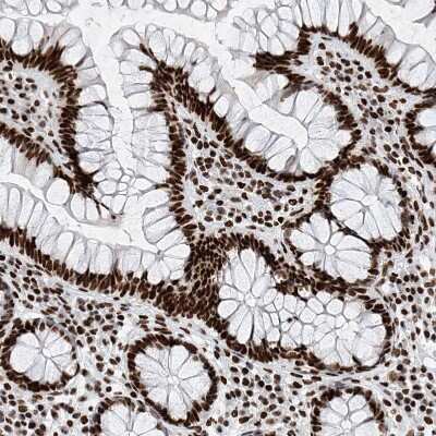 Immunohistochemistry-Paraffin: SRp55 Antibody [NBP1-90043]