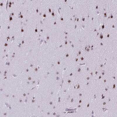 Immunohistochemistry-Paraffin: SS18 Antibody [NBP2-31612]