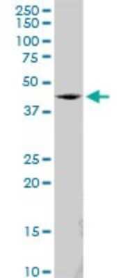 Western Blot: SS18 Antibody [H00006760-B01P]