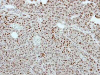 Immunohistochemistry-Paraffin: SS18L1 Antibody [NBP2-20486]