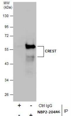 Immunoprecipitation: SS18L1 Antibody [NBP2-20486]