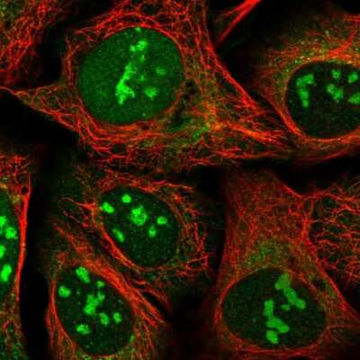 Immunocytochemistry/ Immunofluorescence: SS18L2 Antibody [NBP2-13386]