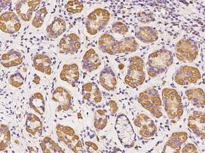 Immunohistochemistry-Paraffin: SS18L2 Antibody [NBP2-98477]