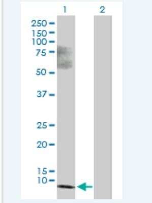 Western Blot: SS18L2 Antibody [H00051188-B04P-50ug]