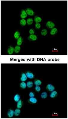 Immunocytochemistry/ Immunofluorescence: SSB Antibody [NBP1-33549]