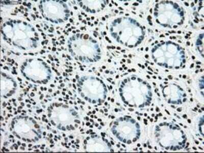 Immunohistochemistry: SSB Antibody (OTI2C8) - Azide and BSA Free [NBP2-74356]