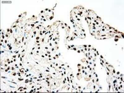Immunohistochemistry: SSB Antibody (OTI2C8) - Azide and BSA Free [NBP2-74356]