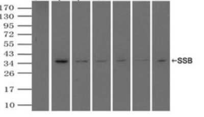 Immunoprecipitation: SSB Antibody (OTI2C8) - Azide and BSA Free [NBP2-74356]