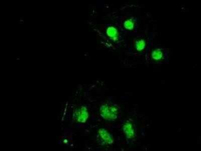 Immunocytochemistry/ Immunofluorescence: SSB Antibody (OTI2C8) [NBP1-48002]