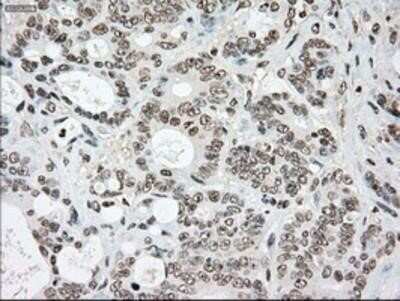 Immunohistochemistry-Paraffin: SSB Antibody (OTI2C8) [NBP1-48002]