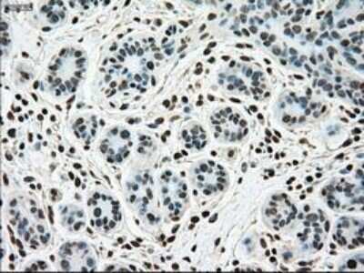 Immunohistochemistry-Paraffin: SSB Antibody (OTI2C8) [NBP1-48002]