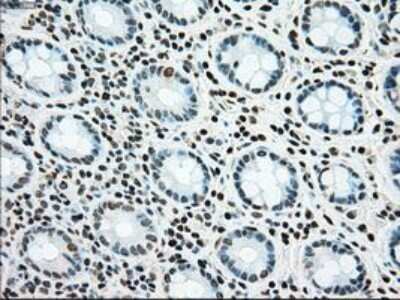 Immunohistochemistry-Paraffin: SSB Antibody (OTI2C8) [NBP1-48002]