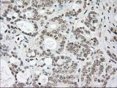 Immunohistochemistry-Paraffin: SSB Antibody (OTI2C8) [NBP1-48002]