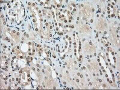 Immunohistochemistry-Paraffin: SSB Antibody (OTI2C8) [NBP1-48002]