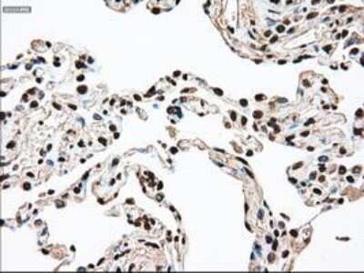 Immunohistochemistry-Paraffin: SSB Antibody (OTI2C8) [NBP1-48002]