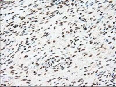 Immunohistochemistry-Paraffin: SSB Antibody (OTI2C8) [NBP1-48002]