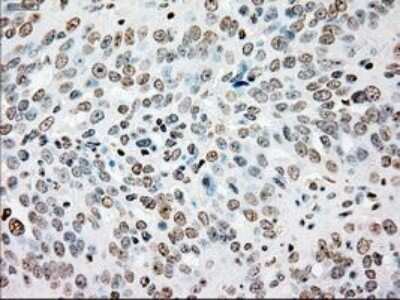 Immunohistochemistry-Paraffin: SSB Antibody (OTI2C8) [NBP1-48002]