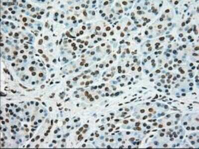 Immunohistochemistry-Paraffin: SSB Antibody (OTI2C8) [NBP1-48002]