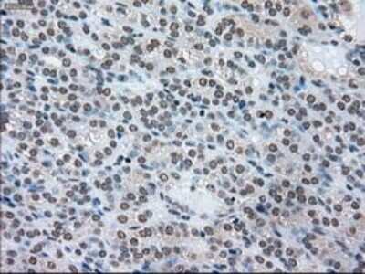 Immunohistochemistry-Paraffin: SSB Antibody (OTI2C8) [NBP1-48002]