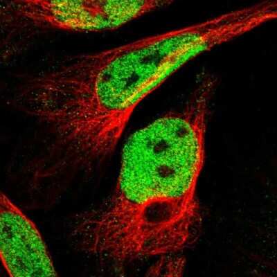 Immunocytochemistry/ Immunofluorescence: SSBIP1/SOSS-C Antibody [NBP1-81682]