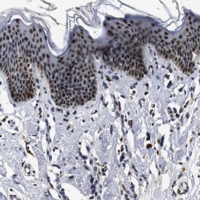 Immunohistochemistry-Paraffin: SSBIP1/SOSS-C Antibody [NBP1-81682]