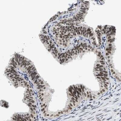 Immunohistochemistry-Paraffin: SSBIP1/SOSS-C Antibody [NBP1-81682]