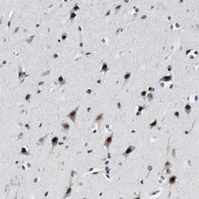 Immunohistochemistry-Paraffin: SSBIP1/SOSS-C Antibody [NBP1-81682]