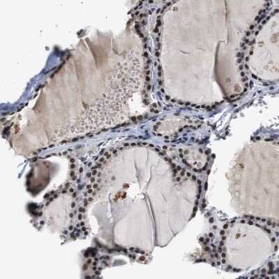 Immunohistochemistry-Paraffin: SSBIP1/SOSS-C Antibody [NBP1-81682]
