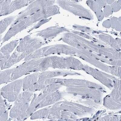 Immunohistochemistry-Paraffin: SSBIP1/SOSS-C Antibody [NBP1-81682]