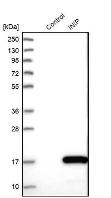 Western Blot: SSBIP1/SOSS-C Antibody [NBP1-81682]