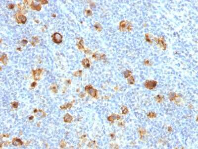 Immunohistochemistry-Paraffin: SSEA-1 Antibody (FUT4/1478R) [NBP2-49878]