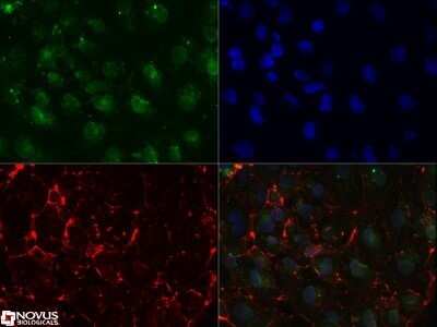 Immunocytochemistry/ Immunofluorescence: SSEA-1 Antibody (MC-480) - Azide and BSA Free [NBP2-80961]