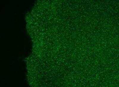 Immunocytochemistry/ Immunofluorescence: SSEA-3 Antibody (MC-631) [NB100-1832]