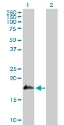 Western Blot: SSH2 Antibody [H00085464-D01P]