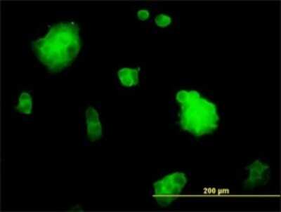 Immunocytochemistry/ Immunofluorescence: SSH3 Antibody (6F9) [H00054961-M01]