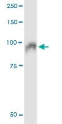 Immunoprecipitation: SSH3 Antibody (6F9) [H00054961-M01]