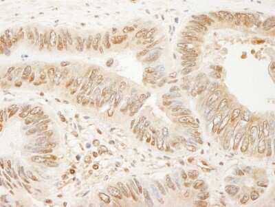 Immunohistochemistry: SSH3 Antibody [NB100-60675]