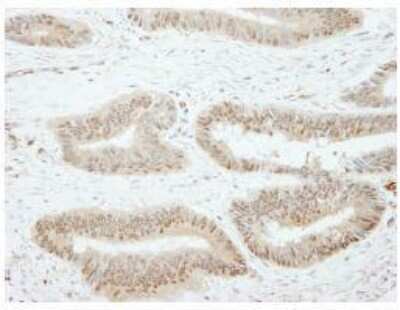 Immunohistochemistry-Paraffin: SSH3 Antibody [NB100-60675]