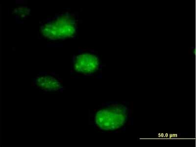 Immunocytochemistry/ Immunofluorescence: SSNA1 Antibody [H00008636-B01P]