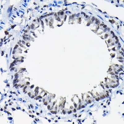 Immunohistochemistry-Paraffin: SSNA1 Antibody - BSA Free [NBP2-94036]