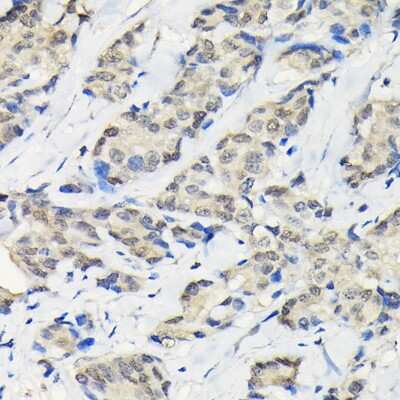 Immunohistochemistry-Paraffin: SSNA1 Antibody - BSA Free [NBP2-94036]