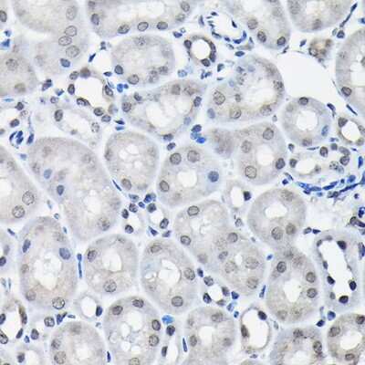 Immunohistochemistry-Paraffin: SSNA1 Antibody - BSA Free [NBP2-94036]