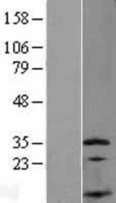 Western Blot: SSNA1 Overexpression Lysate [NBP2-07961]