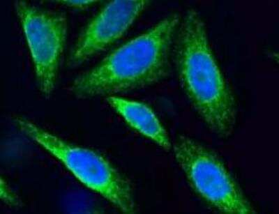 Immunocytochemistry/ Immunofluorescence: SSR2 Antibody (31G6) - BSA Free [NBP2-42647]