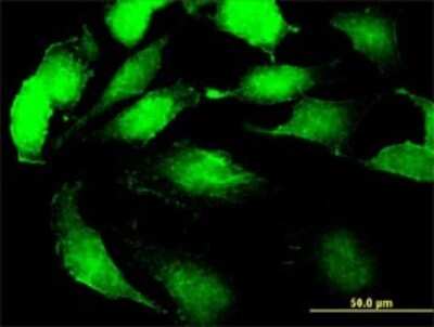 Immunocytochemistry/ Immunofluorescence: SSR2 Antibody (4C1) [H00006746-M01]