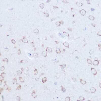 Immunohistochemistry-Paraffin: SSR2 Antibody - Azide and BSA Free [NBP3-16018]